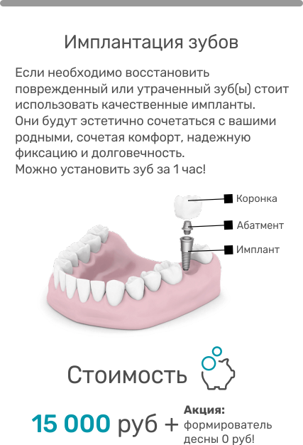 Установка импланта зуба отзывы пациентов